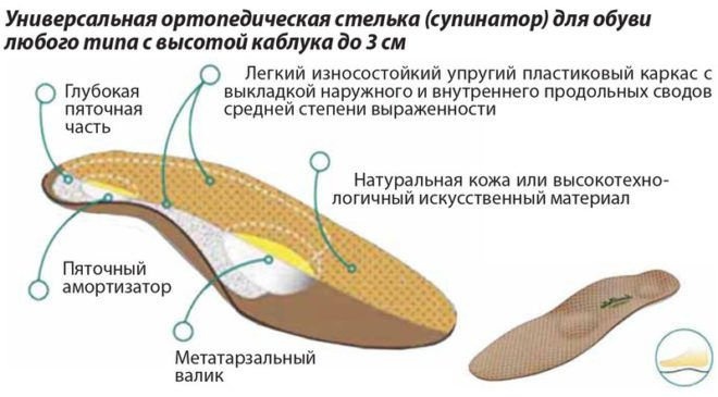 Что такое супинатор на обуви